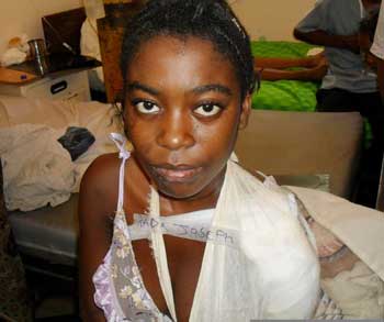 A young Haitian woman awaits medical treatment at a clinic in the Dominican Republic. (Courtesy photo) A young Haitian woman awaits medical treatment at a clinic in the Dominican Republic. (Courtesy photo)